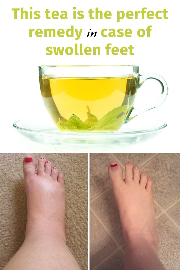this-tea-is-the-perfect-remedy-in-case-of-swollen-feet